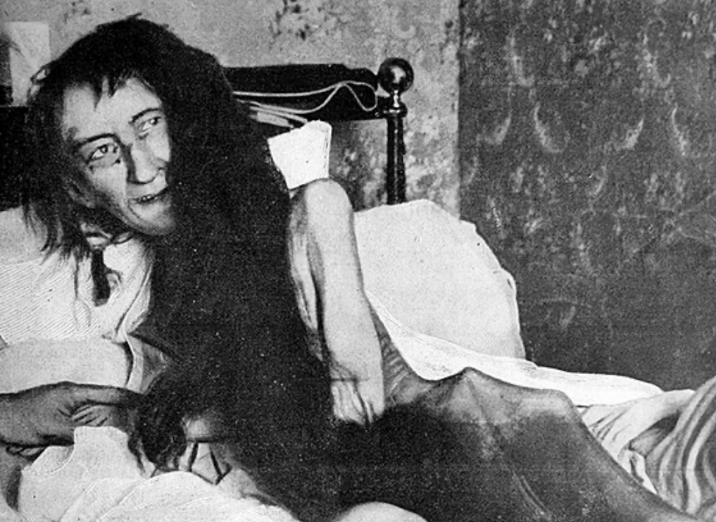 The Tragic Story of Blanche Monnier, Locked Away From Society for 25 Years