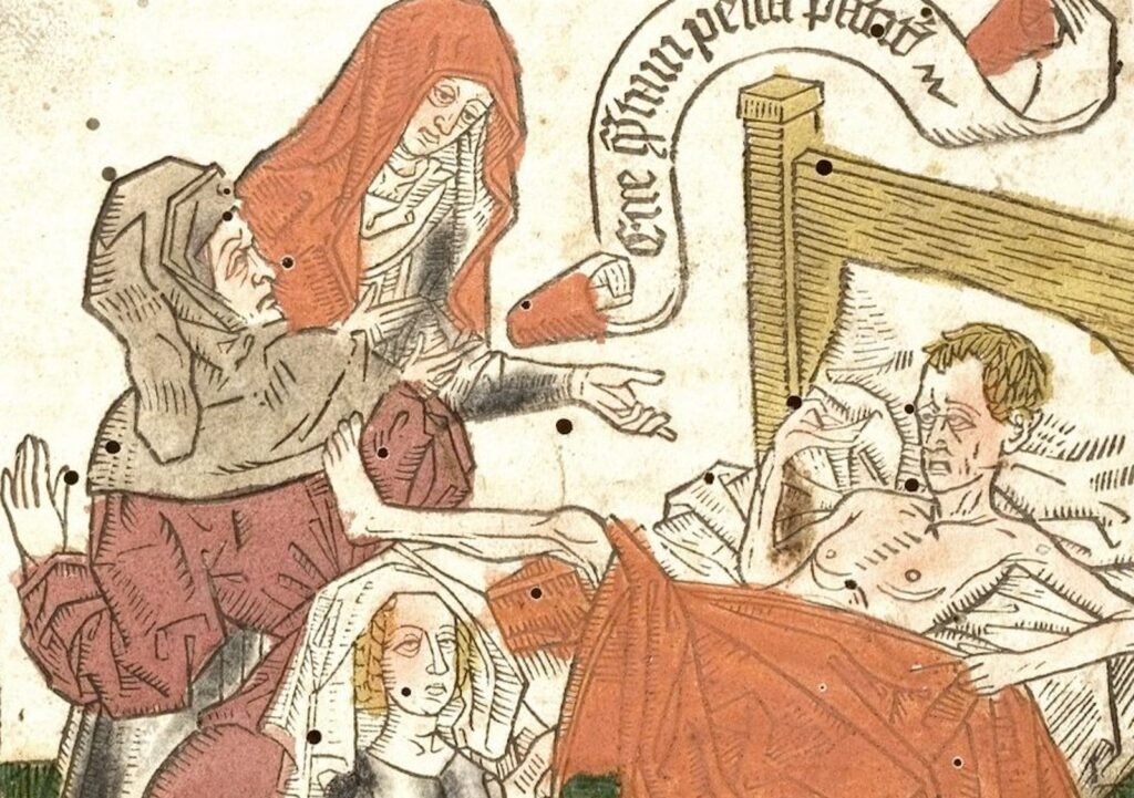 What Was The English Sweating Sickness What Was The English Sweating Sickness